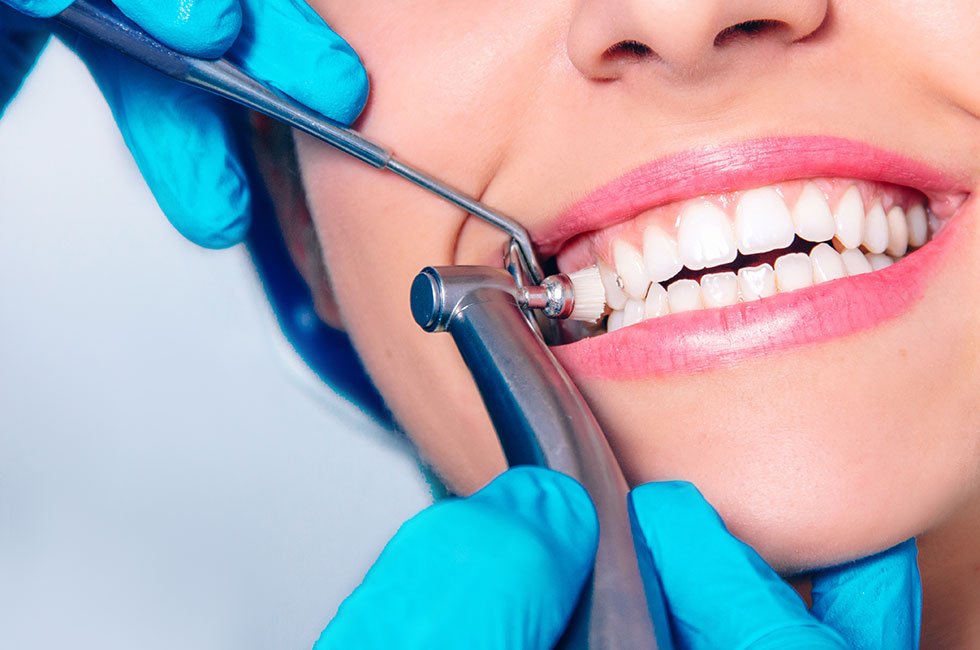 Teeth Cleaning